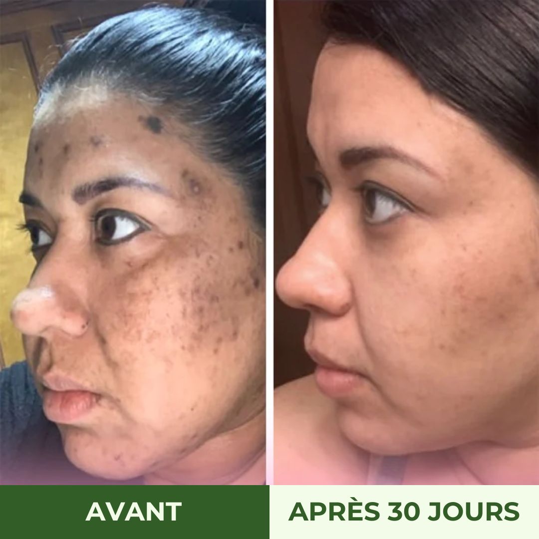 Pads nettoyantes au curcuma Radiance Los Angeles