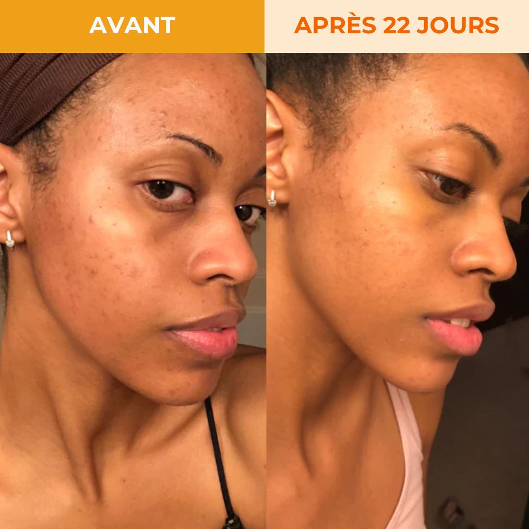 Sérum au Curcuma Radiance Los Angeles