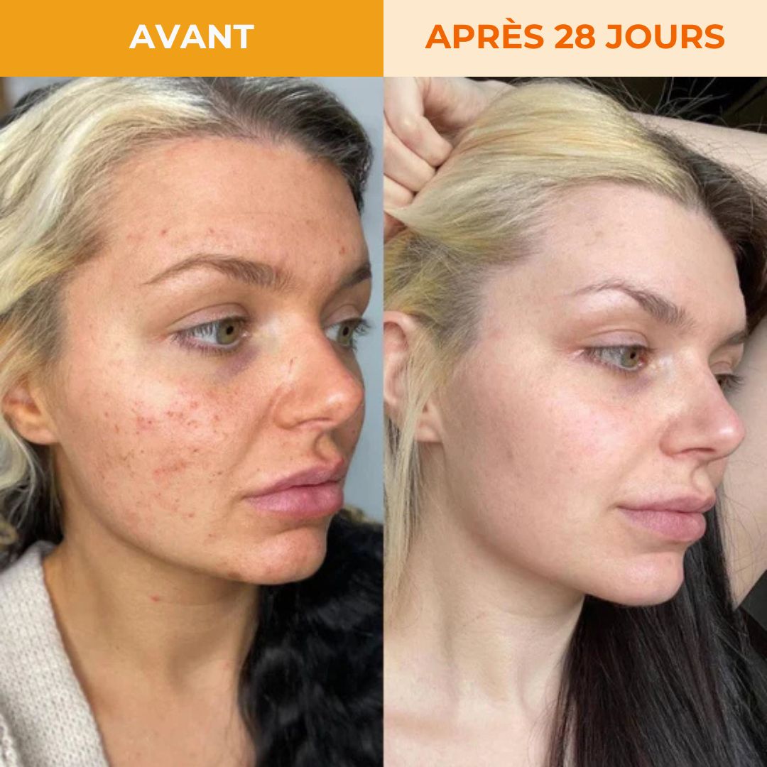 Sérum au Curcuma Radiance Los Angeles